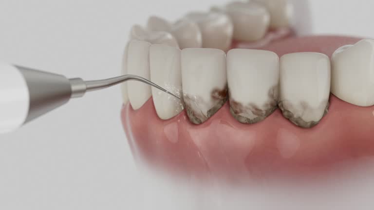 Reliable Dental contractor in Haskins, OH by Smile Center Dentistry